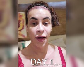 Carla Brasil aka carlabrasil2020 OnlyFans - HAIR TRANSPLANT UPDATE Day 1 and day 5 This video is meant only for those who may be interested