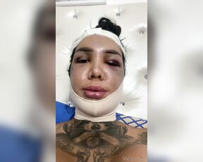 Vicosexx aka Vicosexx OnlyFans - Estoy en recuperacin de Ku ciruga de feminizacin facial, todo gracias a ustedes los amo no me o 4