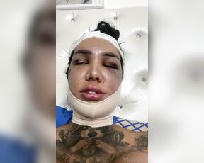 Vicosexx aka Vicosexx OnlyFans - Estoy en recuperacin de Ku ciruga de feminizacin facial, todo gracias a ustedes los amo no me o 4