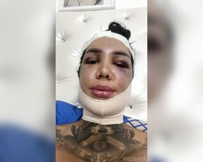 Vicosexx aka Vicosexx OnlyFans - Estoy en recuperacin de Ku ciruga de feminizacin facial, todo gracias a ustedes los amo no me o 4