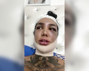 Vicosexx aka Vicosexx OnlyFans - Estoy en recuperacin de Ku ciruga de feminizacin facial, todo gracias a ustedes los amo no me o 4