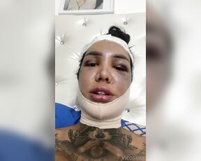 Vicosexx aka Vicosexx OnlyFans - Estoy en recuperacin de Ku ciruga de feminizacin facial, todo gracias a ustedes los amo no me o 4